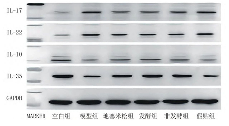 空白組和支氣管哮喘各組大鼠肺組織中IL－17、IL－22、IL－10、IL－35蛋白表達(dá)電泳圖